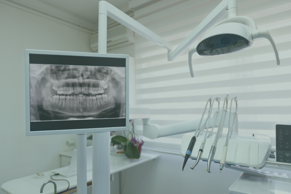 Why Dentists Take a 3D Scan Before an Implant — and the Hidden Things It Reveals