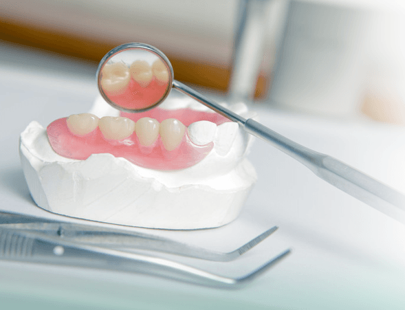 Restorative dentistry at Smiles of Gonzales — crowns, implants, and bridges in Gonzales TX