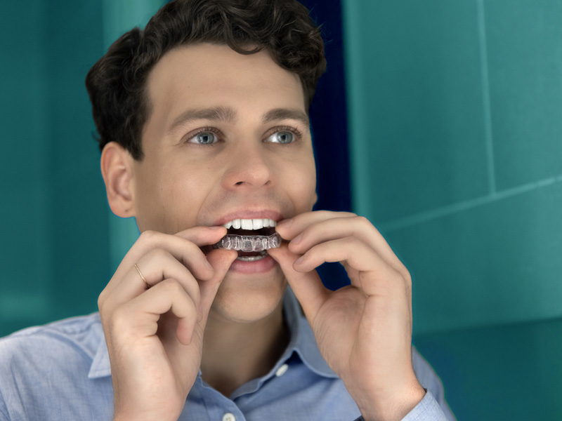 CandidPro Aligners at Smiles of Gonzales TX