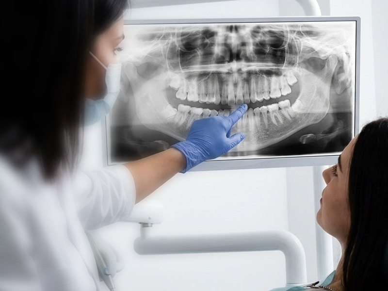 Root Canal at Smiles of Gonzales TX